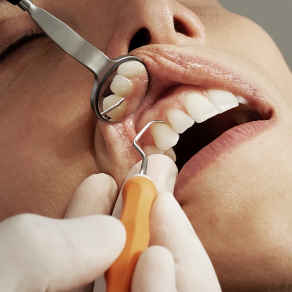 Advanced Gum Treatment
